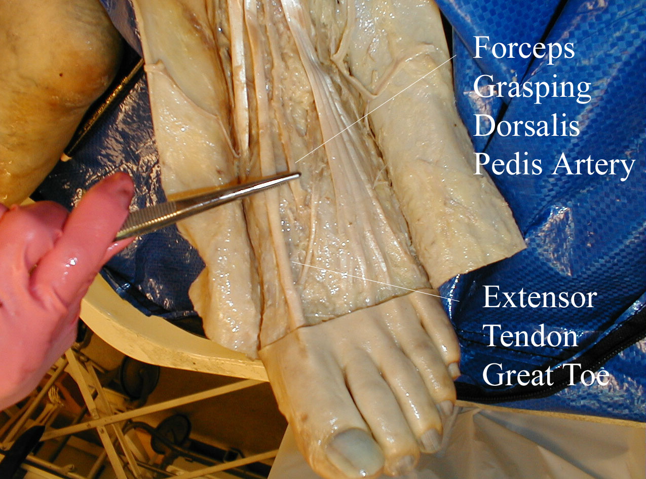Location of the dorsalis pedis artery in relation to surrounding structures (gross anatomy)
