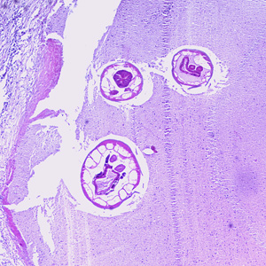 Higher-magnification (200x) of the specimen in Figure 1. Note the large, platymyarian muscle cells (MU) and thick, muscled esophagus (ES). Adapted from CDC