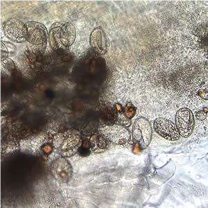Eggs of D. latum within a proglottid. Adapted from CDC