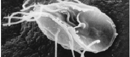 Giardia lamblia, a parasitic diplomonad