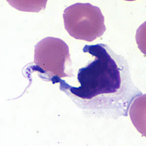 Trypanosoma cruzi trypomastigote in cerebrospinal fluid (CSF) stained with Giemsa. Adapted from CDC