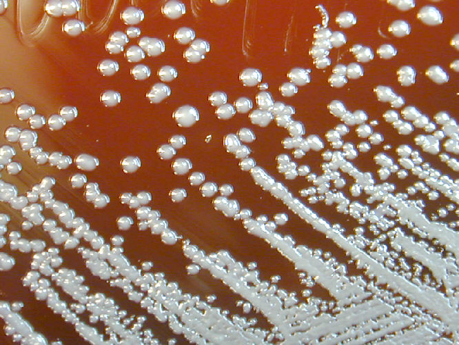 Burkholderia pseudomallei grown on sheep blood agar for 48 hours. From Public Health Image Library (PHIL). [12]