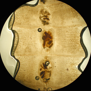 Close-up of a few of the proglottids from the specimen in Figure 1, showing the rosette-shaped uterus at the center of each proglottid. Adapted from CDC