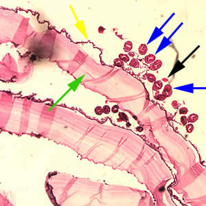 Cross-section of an E. granulosus cyst, stained with H&E. The cyst wall is composed of an acellular laminated external layer (green arrow) and a thin, germinal (nucleated) inner layer (yellow arrow). Note the brood capsule (black arrow) with protoscoleces (blue arrows) inside. Image taken at 40x magnification. Adapted from CDC