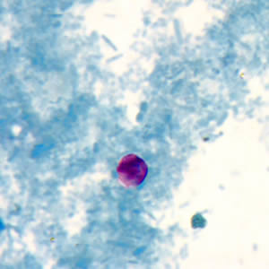 Cryptosporidium sp. oocyst stained with modified acid-fast. Adapted from CDC