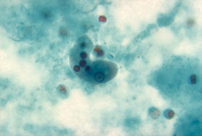 Entamoeba histolytica trophozoite. Adapted from Public Health Image Library (PHIL). [1]