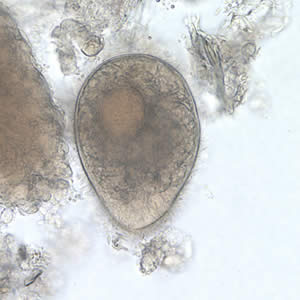 B. coli trophozoite in a wet mount, 500× magnification. Note the visible cilia on the cell surface. Adapted from CDC