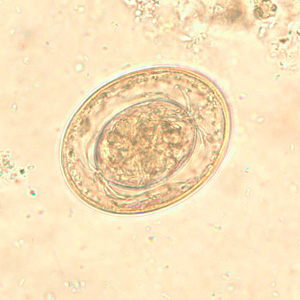 Egg of H. nana in an unstained wet mount. In this image, the polar filaments in the space between the oncosphere and outer shell are clearly visible. Adapted from CDC