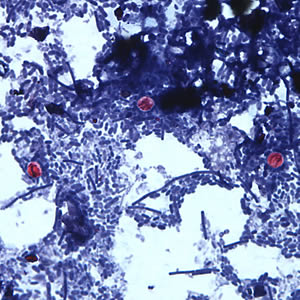 Cryptosporidium sp. oocysts stained with safranin. Adapted from CDC