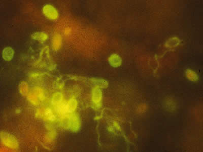 Monoclonal antibody-based immunofluorescence identification of Encephalitozoon hellem. Adapted from CDC
