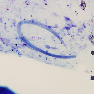 Filariform (L3) larva of S. stercoralis in a sputum specimen, stained with Giemsa. Image taken at 200x magnification. Adapted from CDC