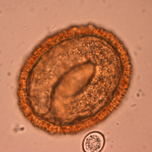 Embryonated eggs of B. procyonis, showing the developing larva inside. Adapted from CDC