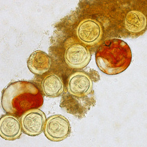 Eggs of Bertiella sp. liberated from proglottids. The proglottids were shed from a human patient who had lived for a number of years in Africa. In several of these eggs, the pyriform apparatus can be easily seen. Images courtesy of Clinipath Pathology, Perth, Australia. Adapted from CDC
