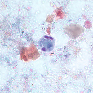 cyst of E. hartmanni stained with trichrome. Notice the bluntly-ended chromatoid bodies