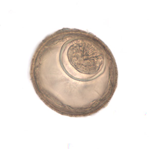 Egg of H. diminuta in an unstained wet mount of concentrated stool. Image taken at 400x magnification. Adapted from CDC