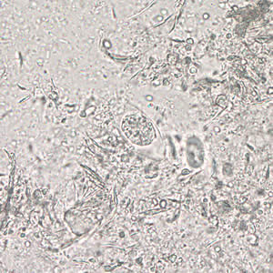 Immature oocyst of C. belli in an unstained wet mount showing a single sporoblast. Adapted from CDC