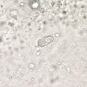 Immature oocyst of C. belli in an unstained wet mount showing two sporoblasts. Adapted from CDC
