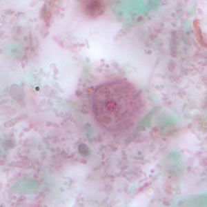 Uninucleate form of a trophozoite of D. fragilis, stained with trichrome. Adapted from CDC