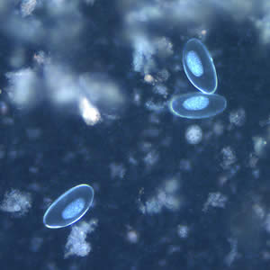 Eggs of E. vermicularis viewed under UV microscopy. Adapted from CDC
