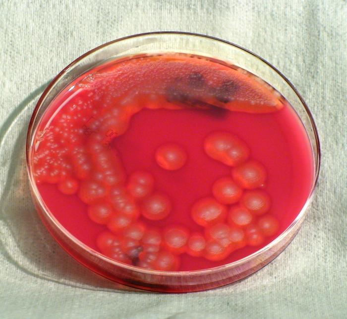 This photograph depicts the colonial morphology displayed by Gram-positive Bacillus cereus bacteria, which was grown on a medium of sheep’s blood agar (SBA), for a 24 hour time period, at a temperature of 37°C. From Public Health Image Library (PHIL). [22]