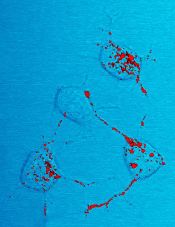 Neural tissue specimen harvested from a scrapie-affected mouse, revealed the presence of prion protein stained in red. From Public Health Image Library (PHIL). [1]