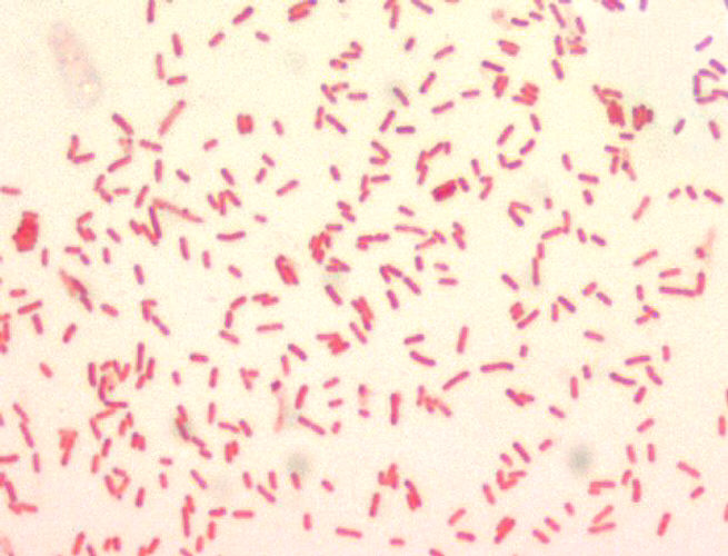 Yersinia pestis, Gram-negative bacillus, 1000x Magnification Adapted from Public Health Image Library (PHIL), Centers for Disease Control and Prevention.[15]