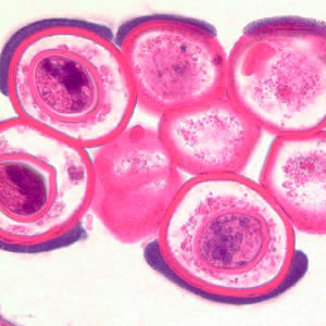 Cross-section of a D. caninum proglottid stained with H&E. Image taken at 1000x magnification. Adapted from CDC