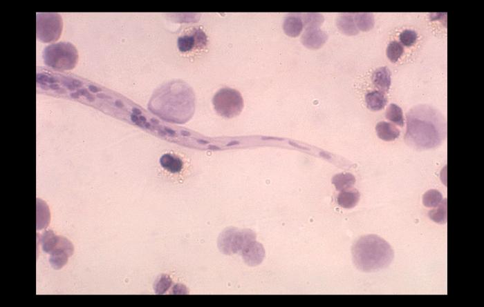 Loa loa, posterior end; Agent of filariasis. From Public Health Image Library (PHIL). [3]