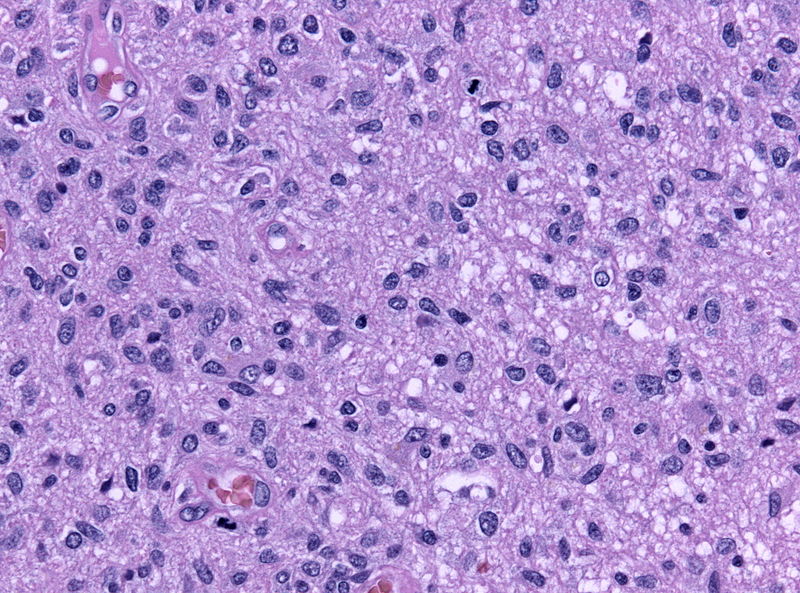 File:800px-Mitoses astro III.jpg