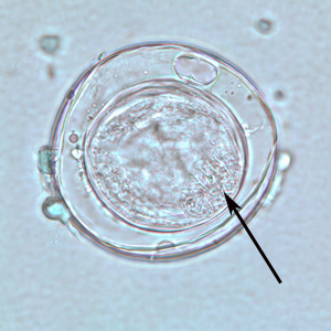 An egg of Bertiella sp. liberated from a gravid proglottid. The arrows point to the hooklets. Adapted from CDC