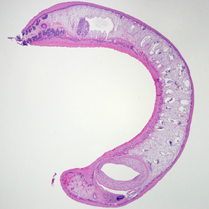 Adult Echinostoma removed during a colonoscopy, stained with hematoxylin and eosin (H&E). Adapted from CDC