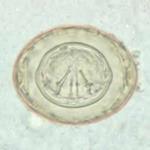 Egg of H. diminuta in a wet mount stained with iodine. Four of the hooks are visible at this level of focus. Adapted from CDC