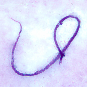 Microfilaria of M. ozzardi in a thick blood smears, stained with Giemsa. Adapted from CDC