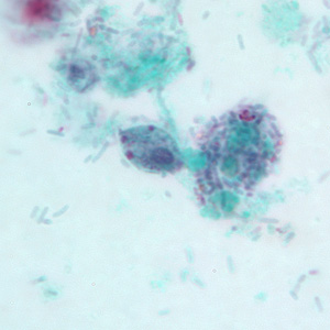 Trophozoite of P. hominis in a stool specimen, stained with trichrome. Adapted from CDC