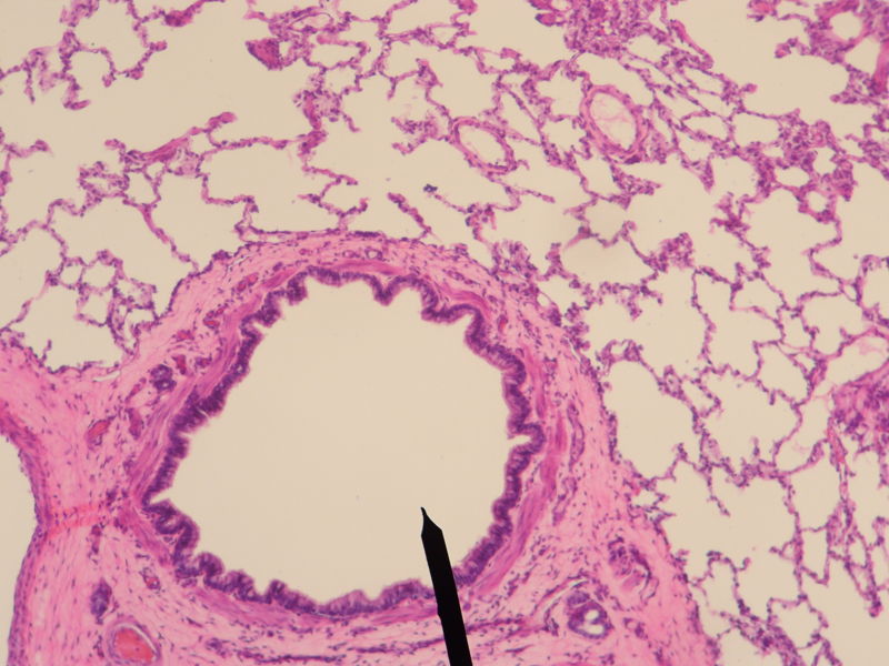 Cross sectional cut of terminal bronchiole