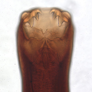 Anterior end of an adult of Ancylostoma caninum, a dog parasite that has been found to produce a rare human infection known as eosinophilic enteritis. Adapted from CDC