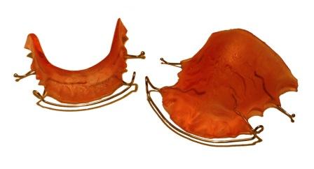 Hawley retainers are the most common type of retainers. This picture shows retainers for the top and bottom of the mouth.