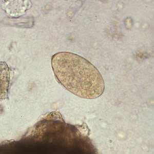 Egg of F. hepatica in an unstained wet mount. Adapted from CDC