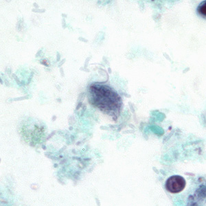 Trophozoite of P. hominis in a stool specimen, stained with trichrome. Adapted from CDC