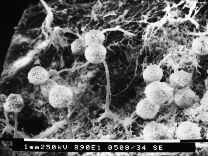 This scanning electron micrograph (SEM) depicts numbers of round asexual Aspergillus sp. fungal fruiting bodies situated amongst a patch of the organism’s septate hyphae. From Public Health Image Library (PHIL). [2]