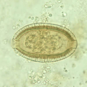 Egg of C. philippinensis in an unstained wet mount of stool. Adapted from CDC