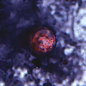 Oocyst of C. cayetanensis stained with safranin (SAF). Adapted from CDC