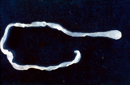 Sparganum removed from the ocular conjunctiva of a patient from Taiwan. The worm measured 40 mm long. Image courtesy of Dr. John H. Cross and the Uniformed Services University of the Health Sciences, Bethesda, MD. Adapted from CDC