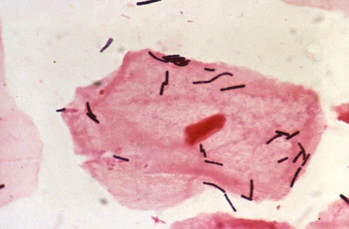 Under a relatively-low magnification of 63X, this Gram-stained photomicrograph of a vaginal specimen revealed the presence of squamous epithelial cells, polymorphonuclear leukocytes (PMNs), or white blood cells (WBCs), and numerous Gram-positive bacilli, or rods. Vaginal specimens are reviewed for many reasons including the Pap test, tests for STDs such as human papilloma virus (HPV) andChlamydia trachomatis , as well as others. The vagina is normally home to a number of bacterial organisms, referred to as vaginal microbiota, or vaginal microflora, composed primarily of rod-shaped Lactobacillus spp., as well as others. Adapted from CDC