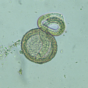 Larva of B. procyonis hatching from an egg. Adapted from CDC