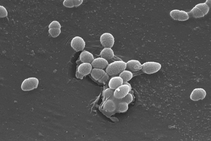 SEM depicts a small group of Gram-positive Enterococcus faecalis bacteria. From Public Health Image Library (PHIL). [4]