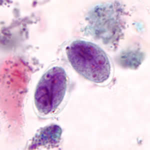 G. duodenalis cyst stained with trichrome. Adapted from CDC