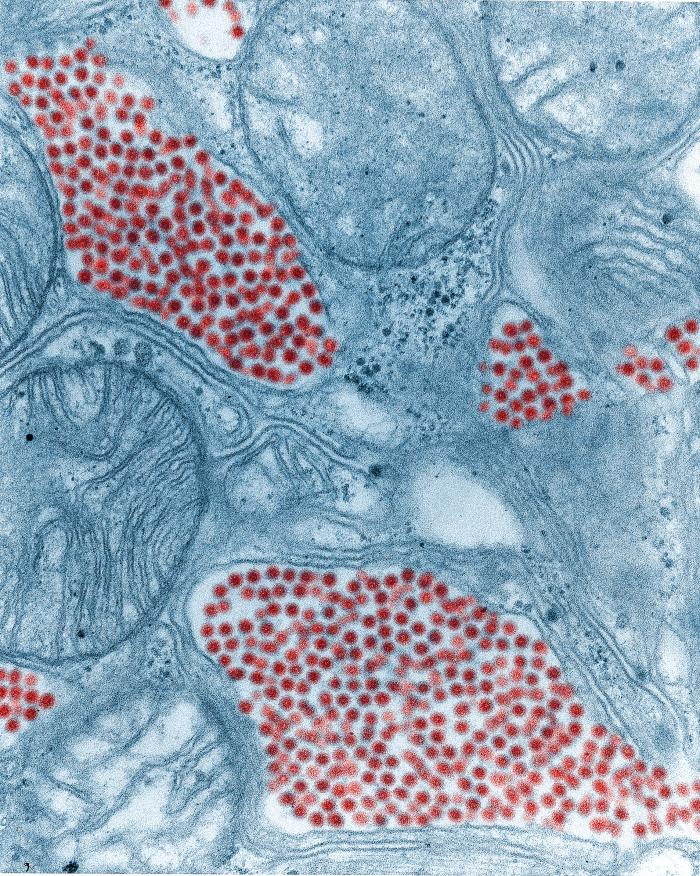 Transmission electron micrograph (TEM) depicts a salivary gland that had been extracted from a mosquito infected by the Eastern equine encephalitis (EEE) virus, colorized red (83900x mag). From Public Health Image Library (PHIL). [1]