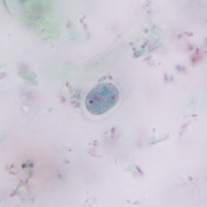 Cyst of E. nana stained with trichrome. Adapted from CDC