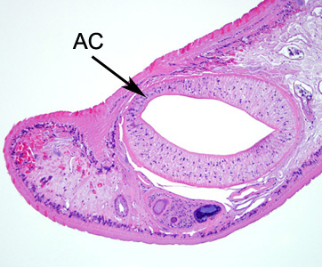 Higher magnification of the anterior end of the specimen in Figure 1. Notice the acetabulum (ventral sucker, AC). Adapted from CDC